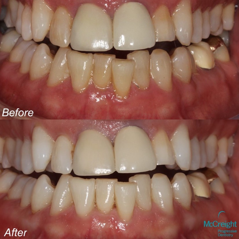 Before and After MPDWay 