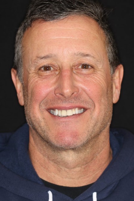 Photo of MPD Client Peter