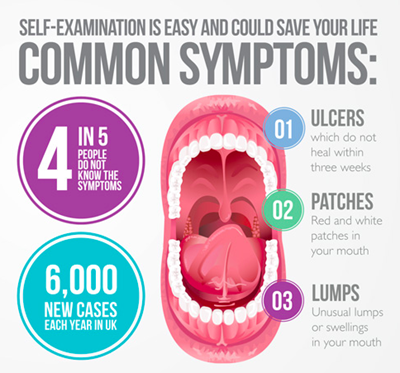 Common symptoms of oral cancer